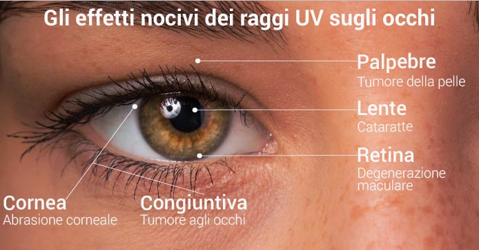 I danni dei raggi UV sugli occhi