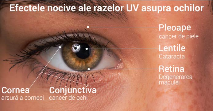 Efectele dăunătoare ale razelor UV asupra ochilor