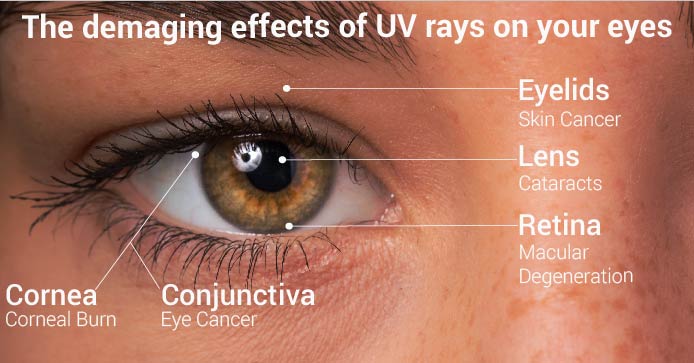 The damaging effects of UV rays on your eyes