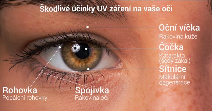 Škodlivé účinky UV paprsků na vaše oči
