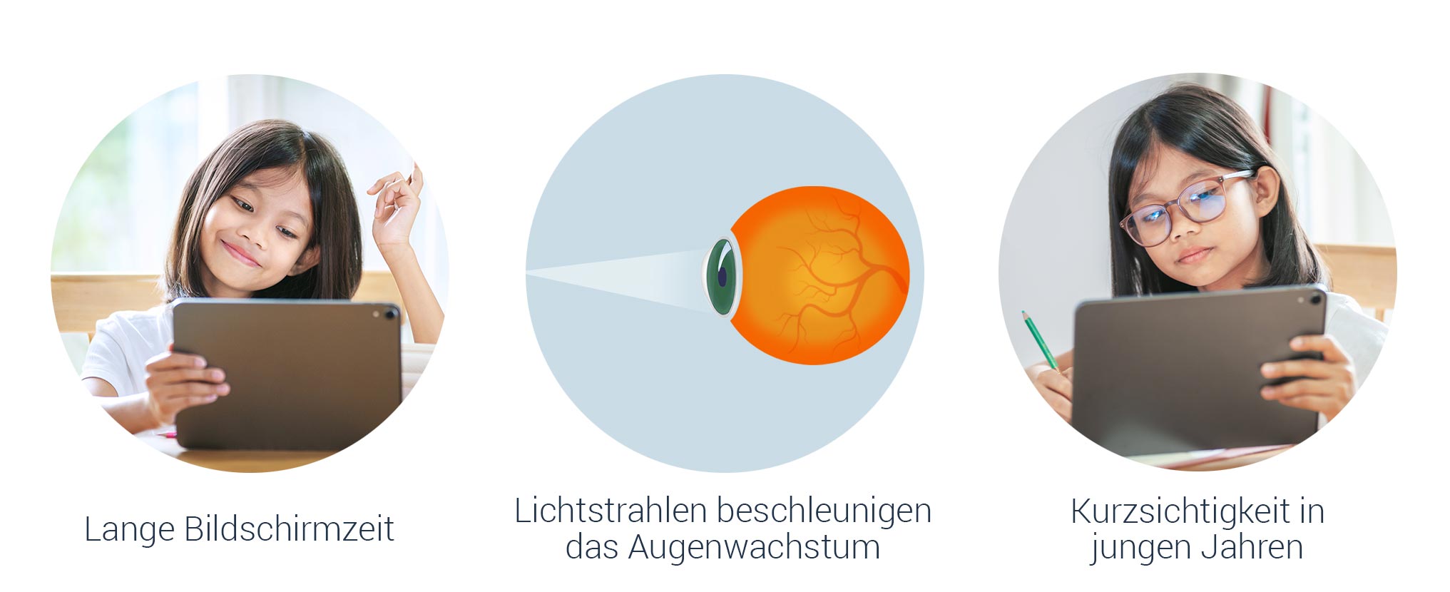 Was verursacht Kurzsichtigkeit bei Kindern?