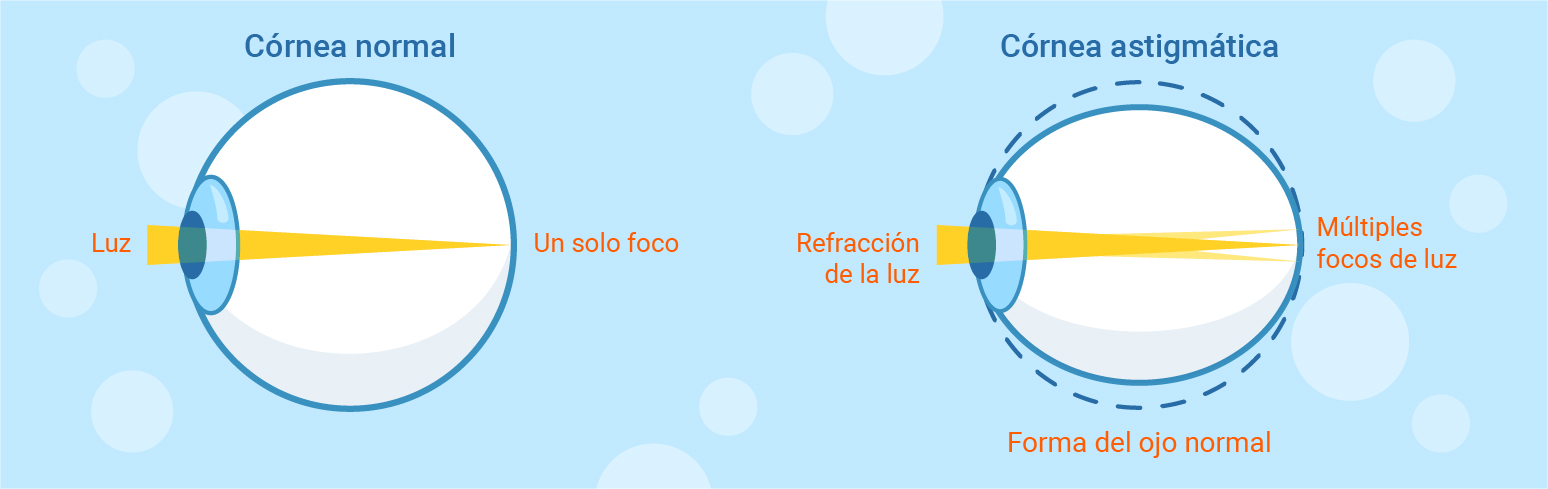 ¿Cuándo podemos decir que vemos bien?